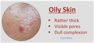 Made Simple Skin Care USDA certified organic Oily Skin Type button