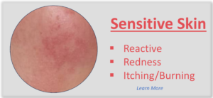 Made Simple Skin Care USDA certified organic Sensitive Skin Type button